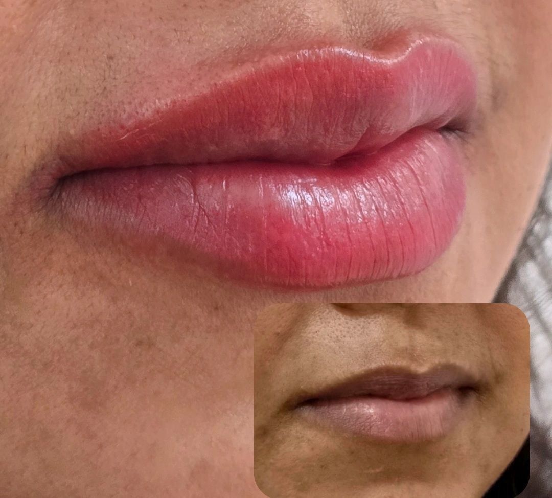 Micropigmentção Labial - Neutralização